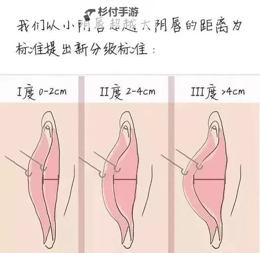 正式解读：正常阴唇的样子照片视频全揭秘图1