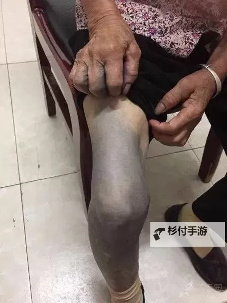 紫黑色肿大横冲直撞：暗黑之中的奇异噩梦图1