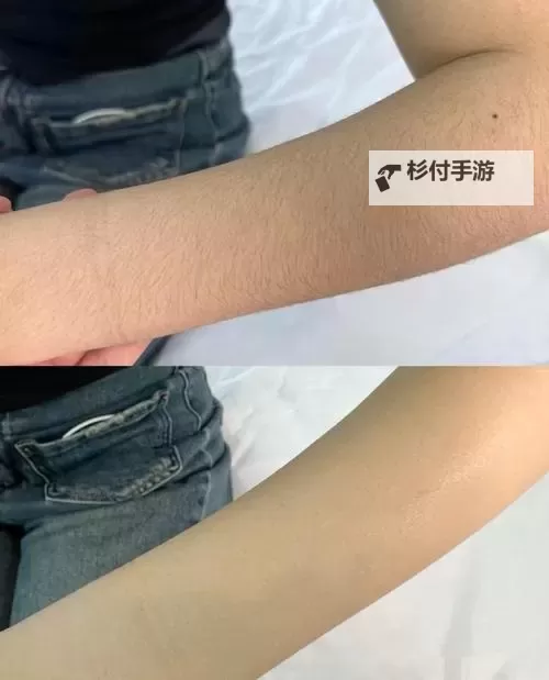 永久脱毛网：打造光滑肌肤的终极解决方案图1